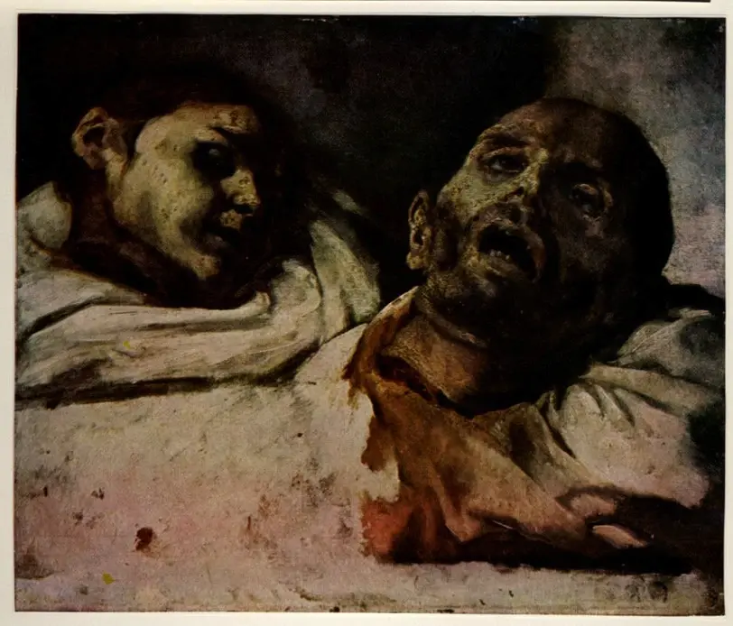 Gericault, Jean Louis , Teste decapitate