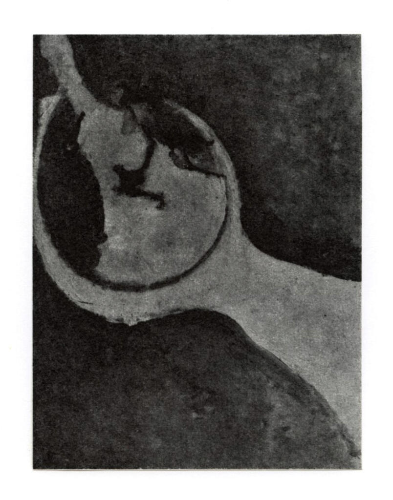 Anonimo , fronte
